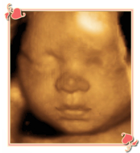 ultrasound charlotte